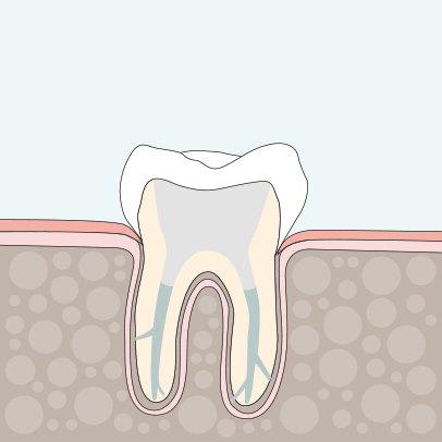 Endodontie Wurzelkanalbehandlung